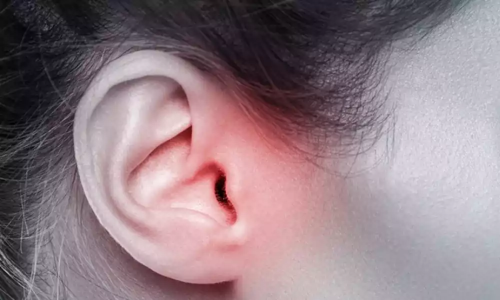 ear infection